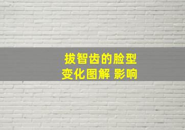 拔智齿的脸型变化图解 影响